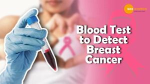Read more about the article A BLOOD TEST TO IDENTIFY BREAST CANCER IN EARLY STAGES
