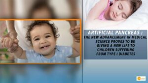 Read more about the article ARTIFICIAL PANCREAS : THE NEW ADVANCEMENT IN MEDICAL SCIENCE PROVES TO BE GIVING A NEW LIFE TO CHILDREN SUFFERING FROM TYPE I DIABETES