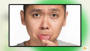 Read more about the article What are Mouth Ulcers: Know its Types and Remedies to cure