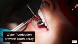 Read more about the article New study reveals Water fluoridation prevents tooth decay and is sustainable technique