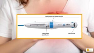 Read more about the article Abbott rolls out TAVI system ‘Navitor’ in India