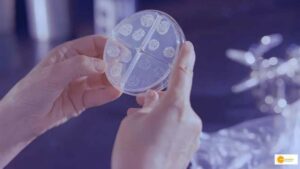 Read more about the article India to get first handheld device that uses AI to detect tuberculosis within a minute