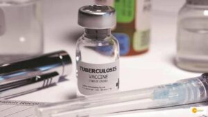 Read more about the article India develops a model to estimate TB burden cases, 1st country to do so