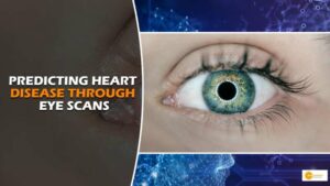 Read more about the article Google’s AI Revolutionizes Cardiovascular Predictions Through Eye Scans