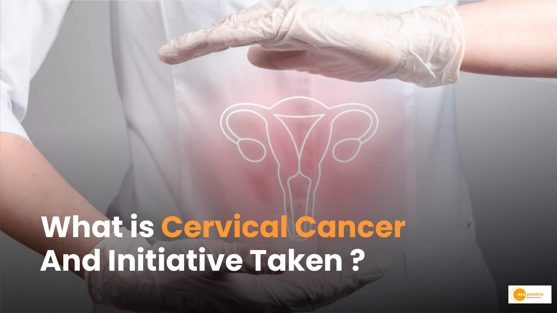 Cervical Cancer