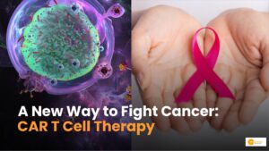 Read more about the article CAR T Cell Therapy: A Cutting-Edge Approach to Cancer Treatment