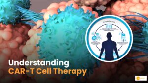 Read more about the article Cancer Treatment: How CAR-T Cell Therapy Works?