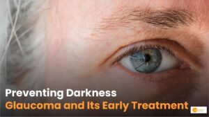 Read more about the article Glaucoma: Understanding and Managing Glaucoma Early